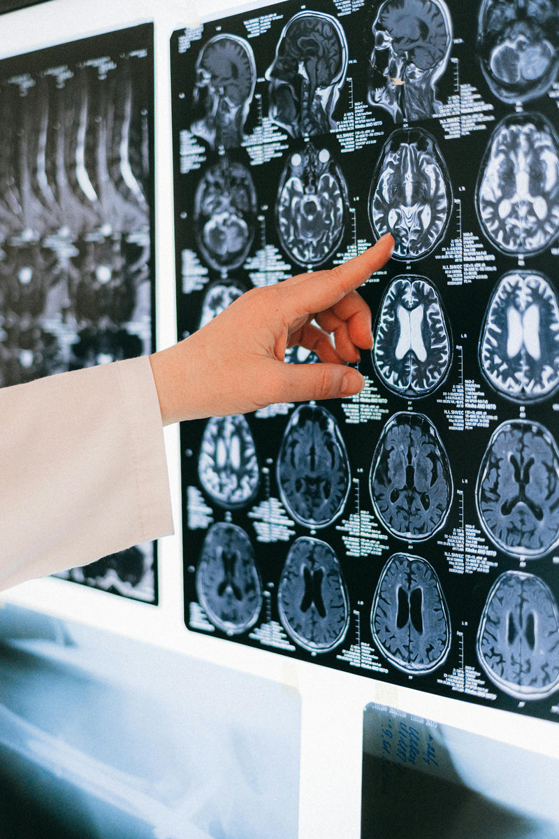 Person pointing at a brain MRI scan on a medical display.